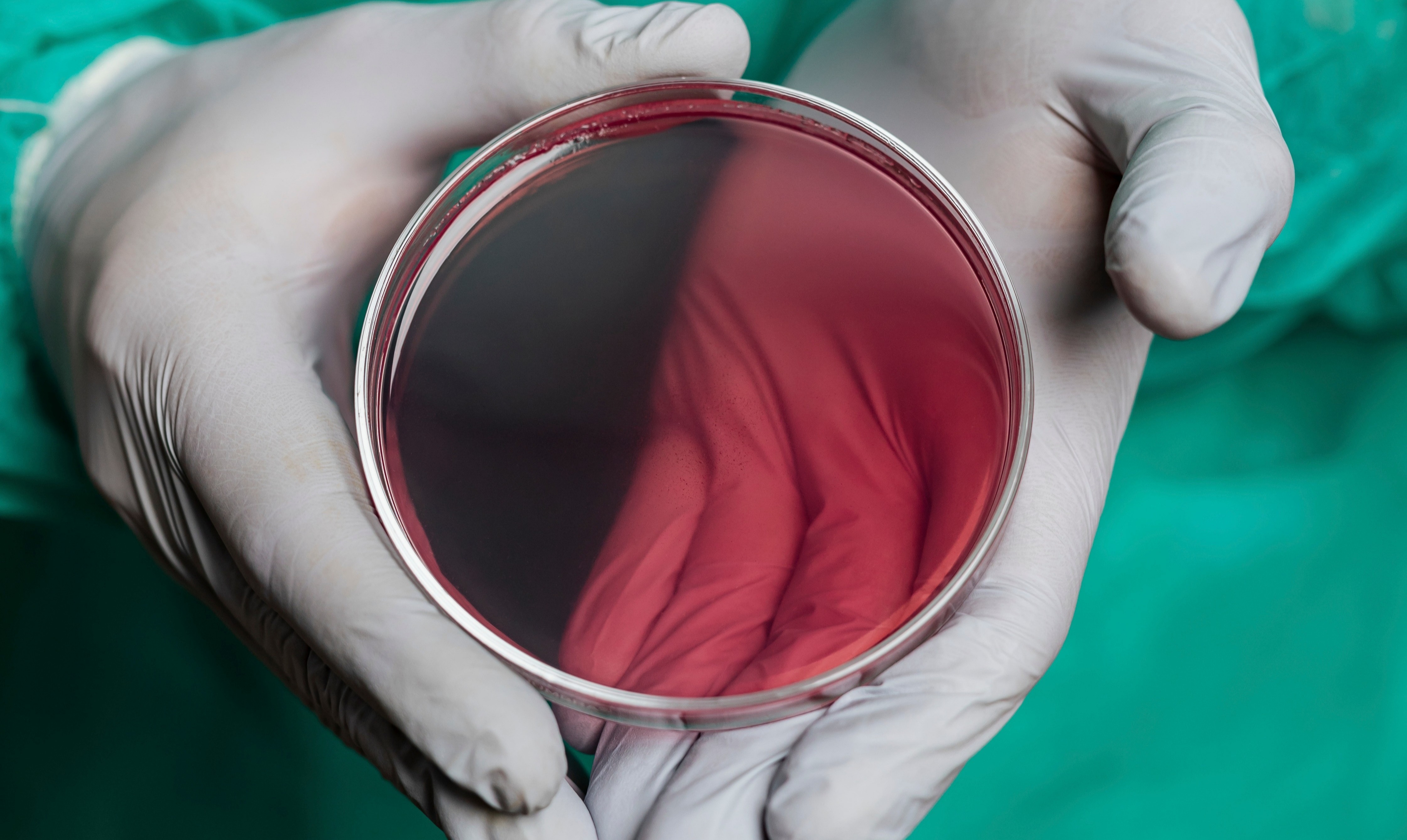 Bioinspired Antibacterial Surfaces Powered by INPART