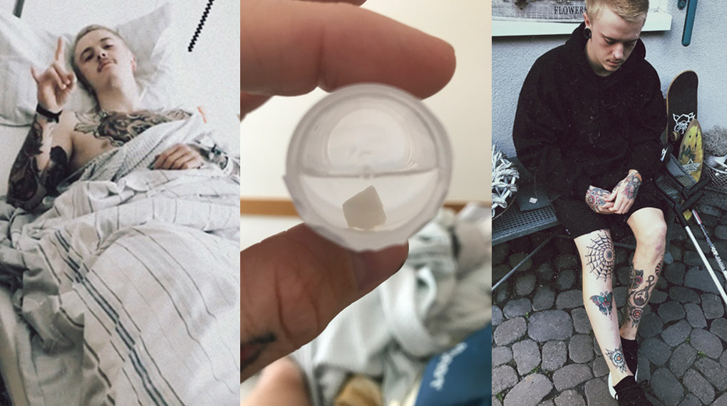 Felix Prangenberg ist derzeit mit einem Knorpelschaden am Knie außer Gefecht. Wie es dazu kam (ganz dumme Geschichte), erzählt er in diesem Interview.