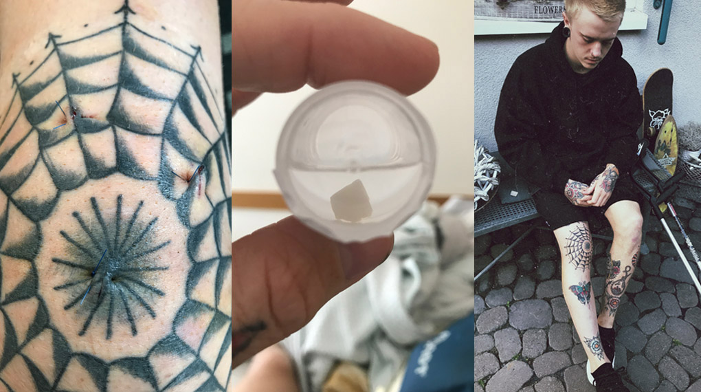 Das verdammte Knie: Felix Prangenberg hat sich einen Knorpelschaden zugezogen