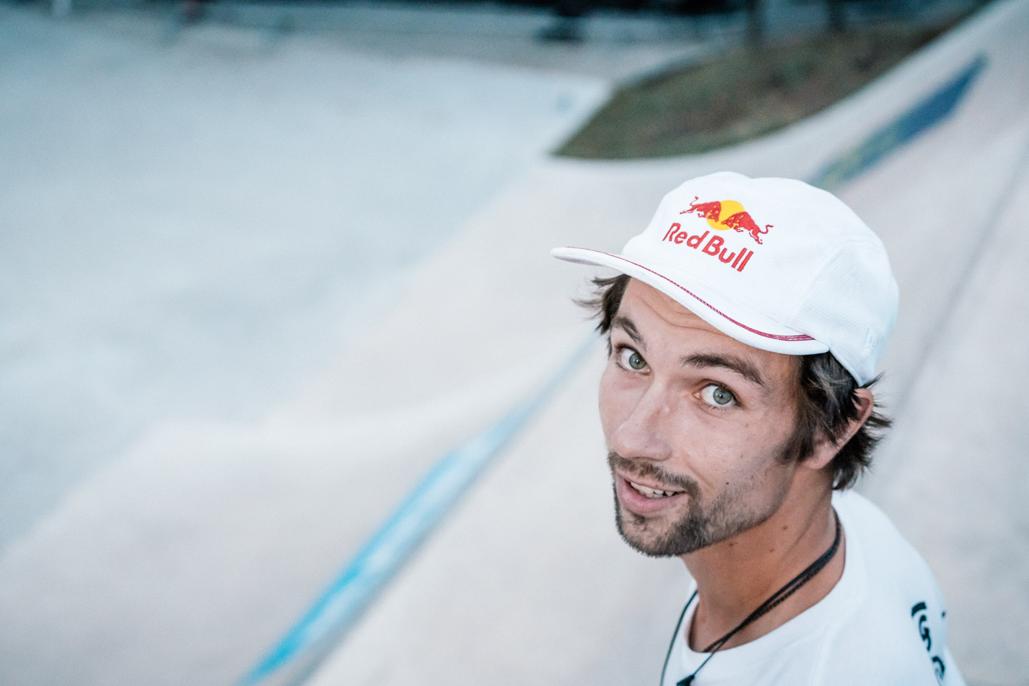 Anthony Perrins halber kleiner Finger besteht aus einer Zyste und er sollte besser aufpassen, dass er nicht all zu hart einschlägt