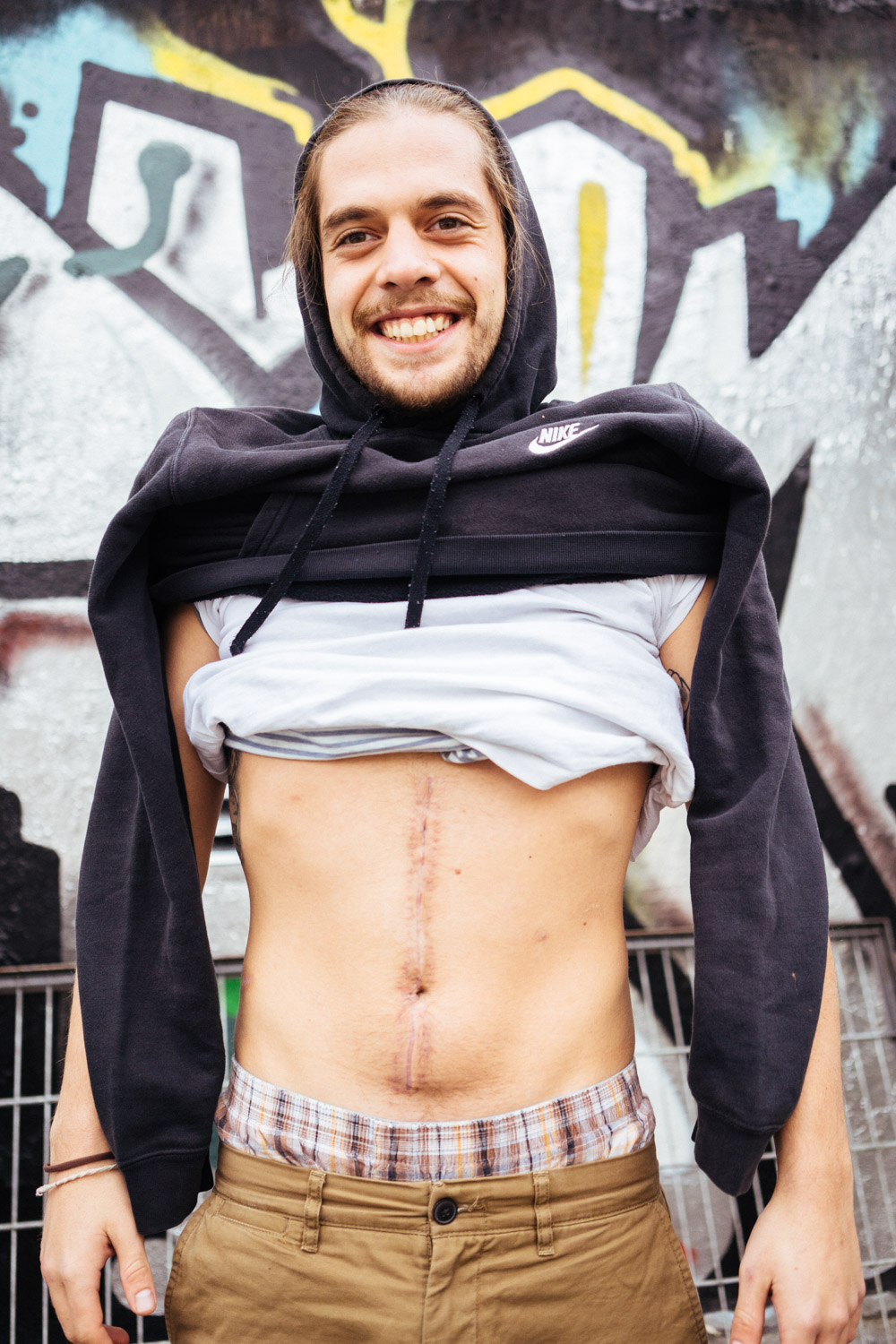 Deniz Dündar wäre auf seinem letzten Australientrip fast an einem Milzriss gestorben. Da er mit dem Schrecken und einer übergroßen Narbe davongekommen ist, hat er jedoch immer noch gut lachen