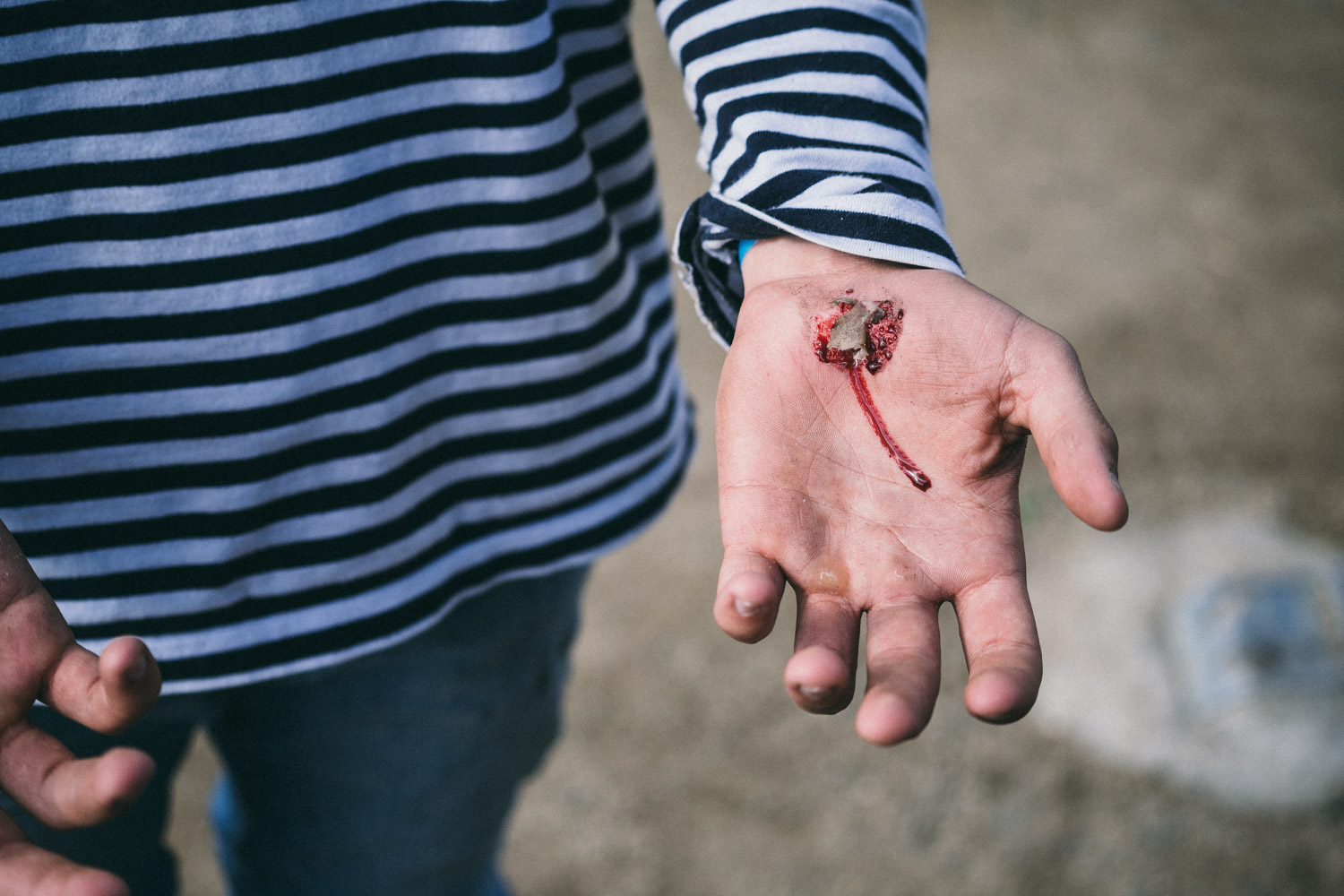 Nico Dietz meinte es ein wenig zu gut mit der Motivation und stürzte hart auf dem Darmstädter Käseraspelboden™