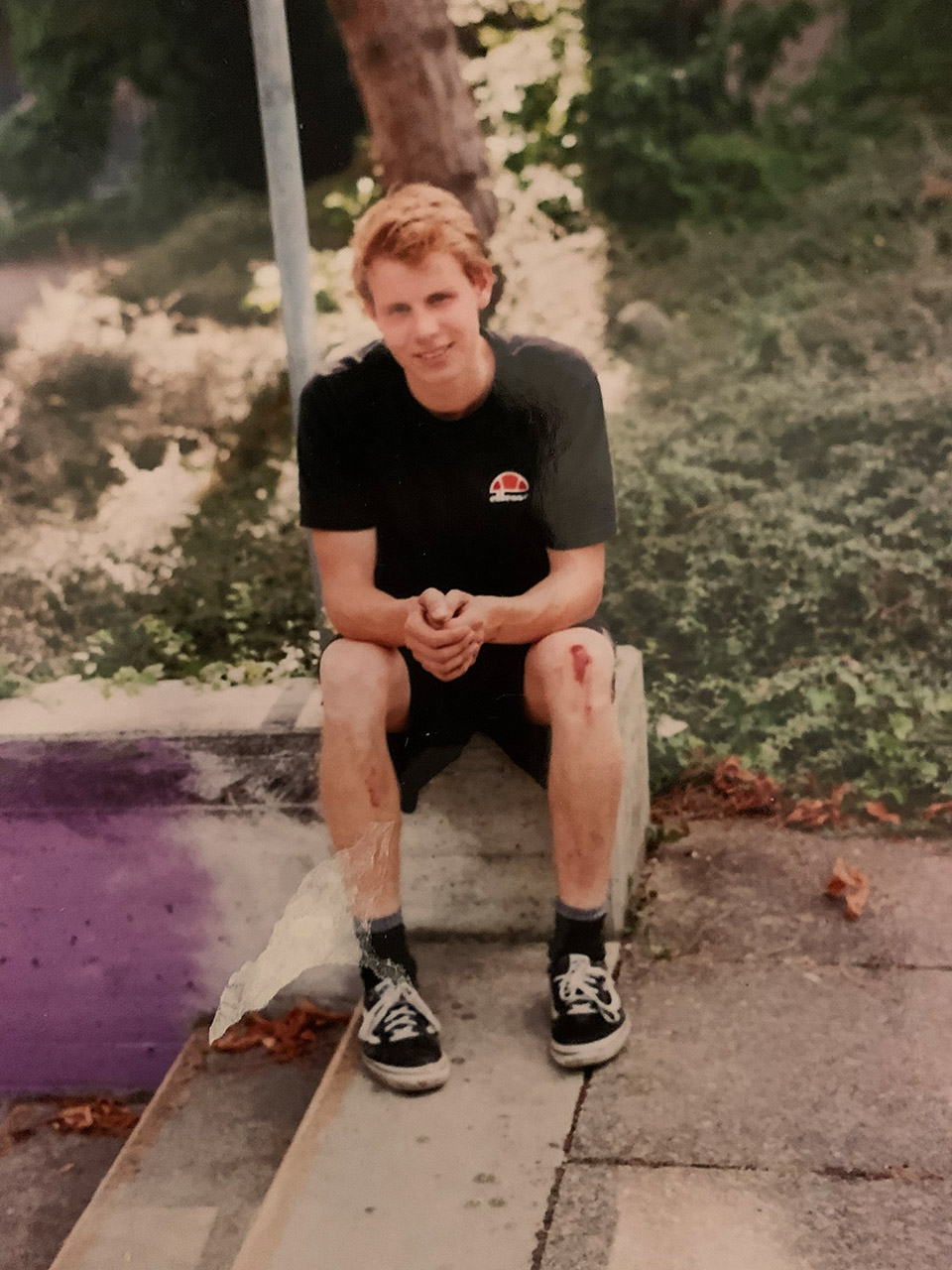 Wenn Cai von Rumohr wirklich so gut ist, warum hat er dann so kaputte Knie?