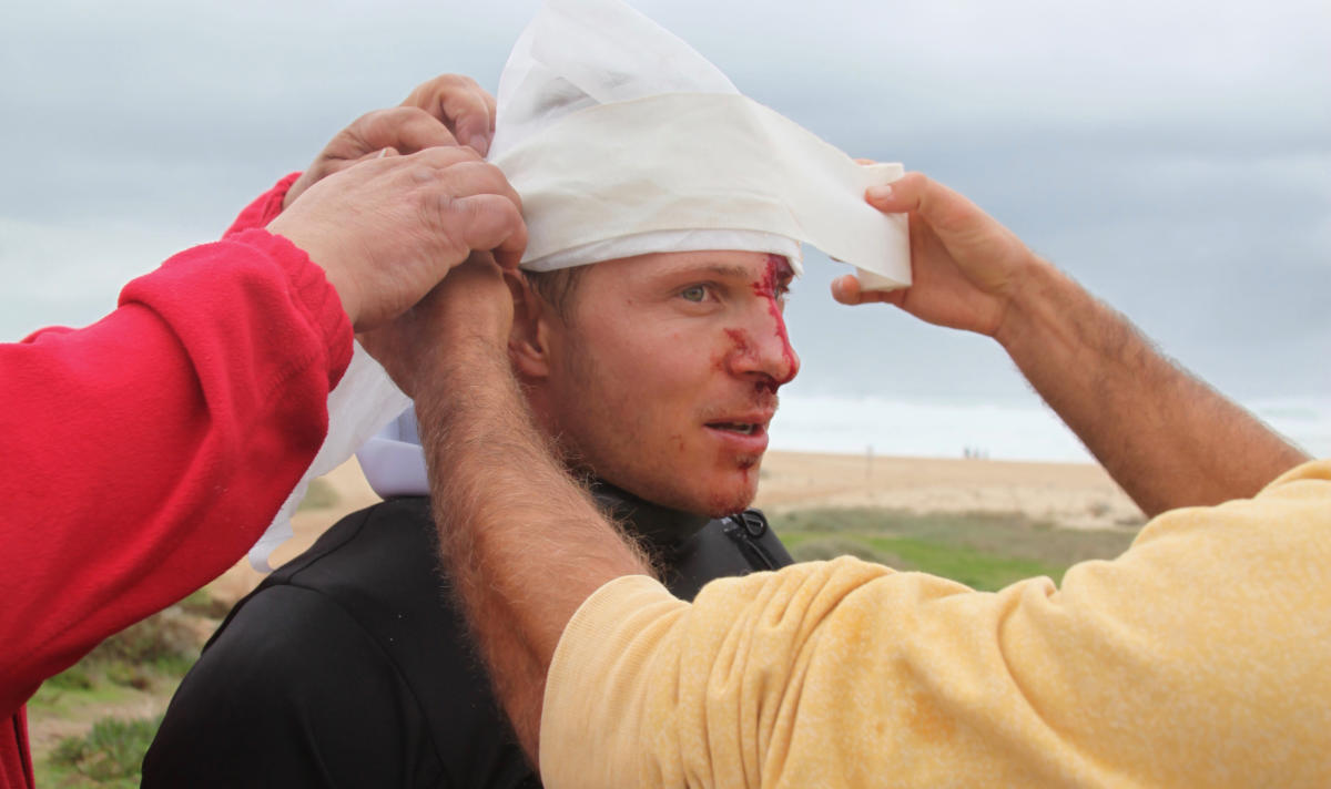 Sebastian Steudtner injury wipeout nazare