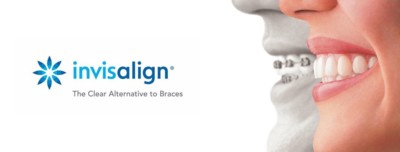 Invisalign®