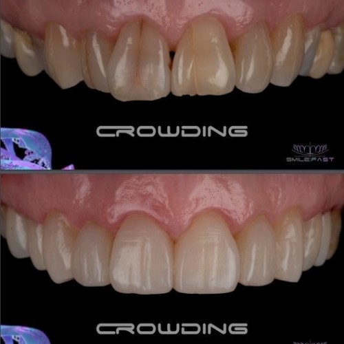 SMILEFAST Eyes & Smiles Expert 5* Dentist in Friern N11