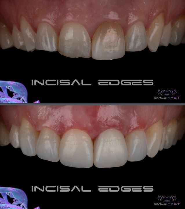 SMILEFAST Eyes & Smiles Expert 5* Dentist in Friern N11