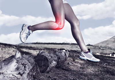 Chronic Joint & Tendon Pain Embolization - Image 1