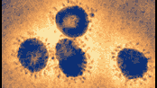SARS CoV-2 Virus in Perspective
