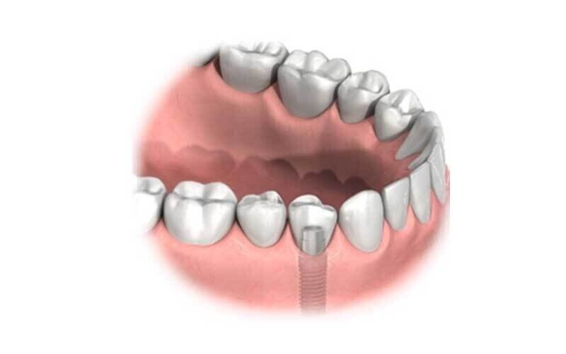 Treatment Options