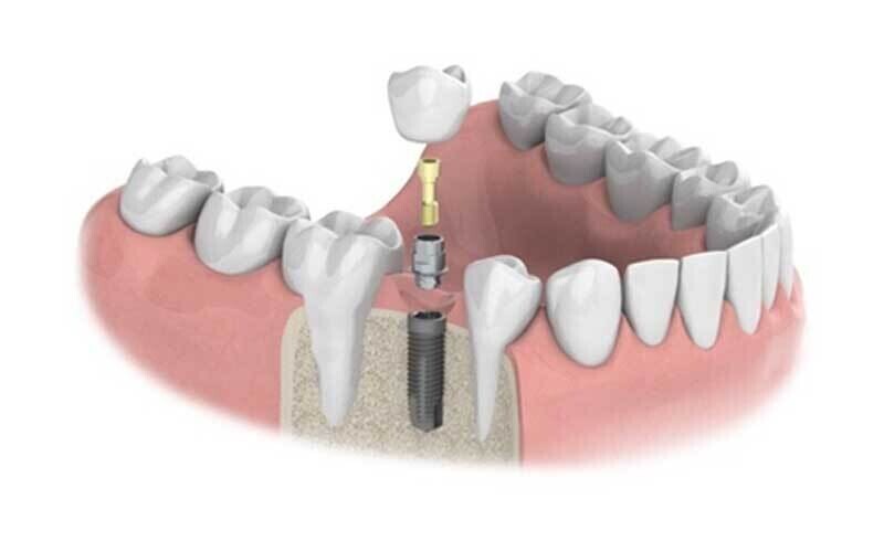 Treatment Options