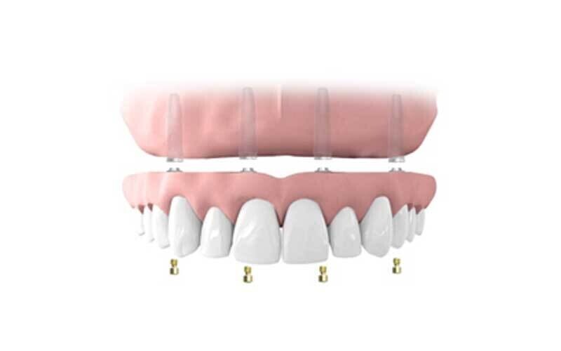 Treatment Options
