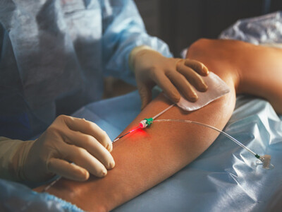 Venous disease