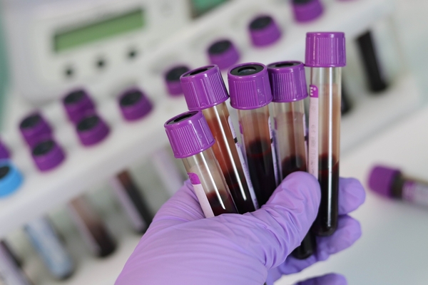 Patients seek out self testing kits as blood tube shortage worsens
