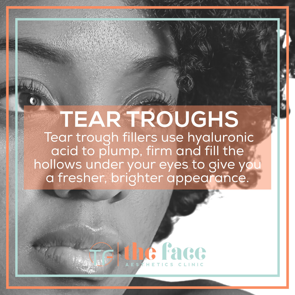 The Face Aesthetics Clinic - Cardiff Cosmetics - Skin Rejuvenation Cardiff - Medical Aesthetics Cardiff - Dermal Fillers Lips - Lip Augmentation - cheek fillers - tear trough fillers