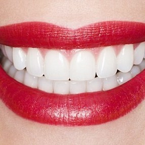 Emergency Dentist N11, Composite Tooth Bonding N11, Teeth Whitening N11