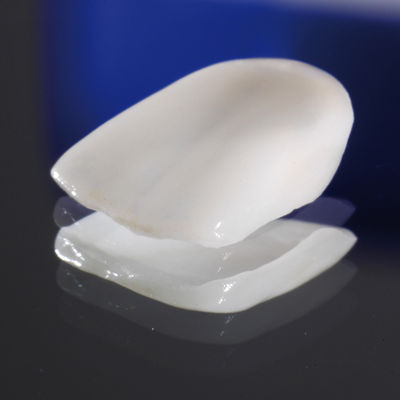 Emergency Dentist N11, Composite Tooth Bonding N11, Teeth Whitening N11