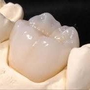 Emergency Dentist N11, Composite Tooth Bonding N11, Teeth Whitening N11