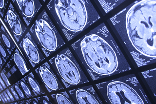 Impact of the New 2017 EU Regulations on Importers and Distributors of Medical Diagnostics