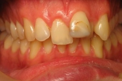 Orthodontics