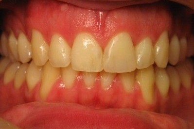 Orthodontics