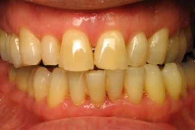 Cosmetic Dentistry