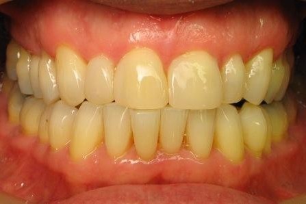 Cosmetic Dentistry