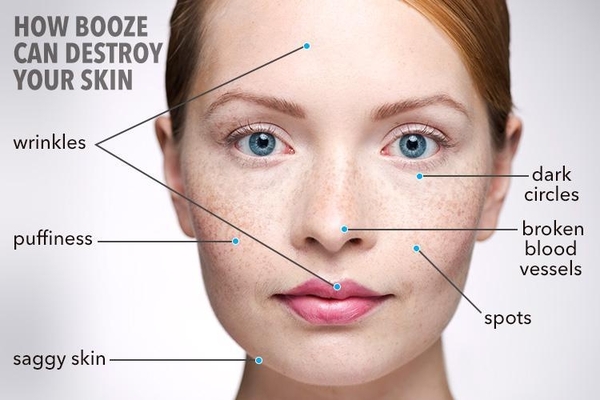 *How to handle your skin hangover*