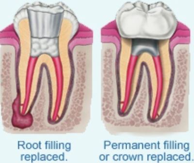 Emergency Dentist N11, Composite Tooth Bonding N11, Teeth Whitening N11