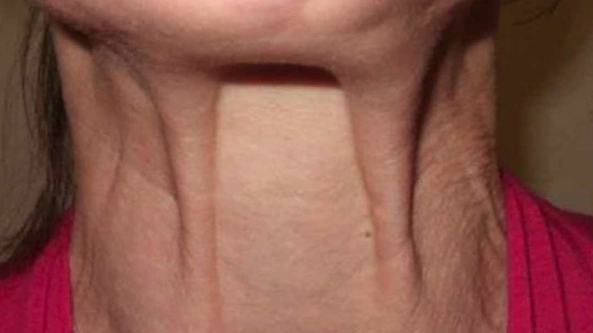 Botox Birmingham, Lip fillers Birmingham, Anti-wrinkle treatment Birmingham