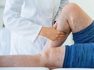 Nottingham Laser Treatments, Nottingham Laser Hair Removal, Shani Beauty Nottingham