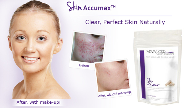 *Problem free skin this Summer!!*