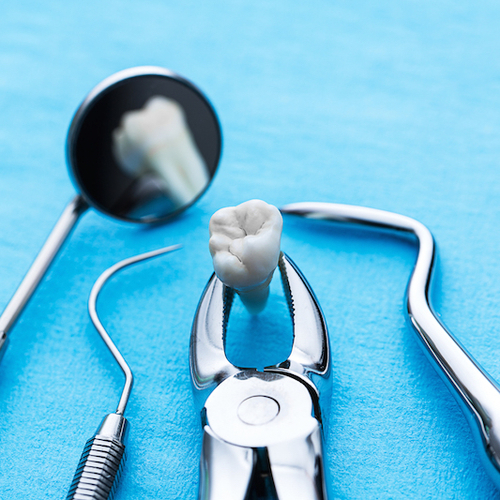 Minor oral surgery Carlton Dental Care Invisalign Dentists NHS