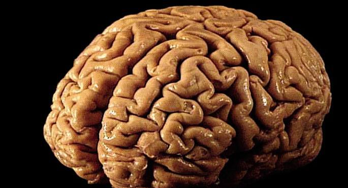 el cerebro humano