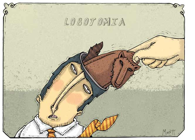 Lobotomía