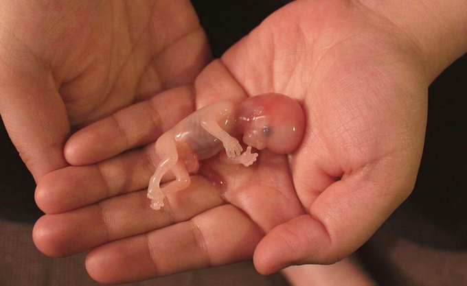 Antaño, era cosa casi de milagro alumbrar una nueva vida