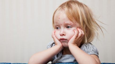 Brennkopper kjerringråd