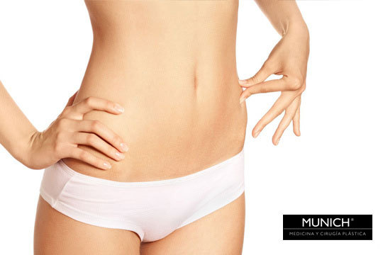 Lipoablación®