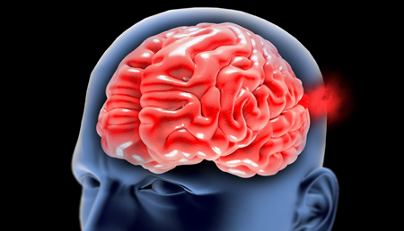 Identifican a la quimioquina CCL20, como posible biomarcador para la detección de aneurisma de aorta abdominal