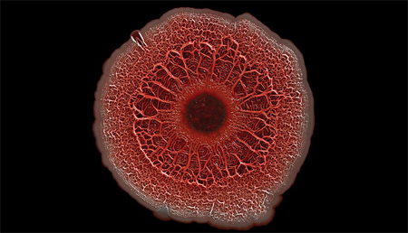 El CSIC desvela cómo se desencadena la resistencia a los antibióticos en una bacteria agresiva en hospitales 