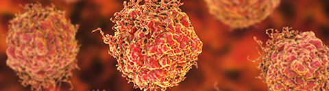 Cáncer de próstata