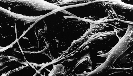 Demuestran el posible papel que ejerce la proteína IKKbeta en el cáncer de piel