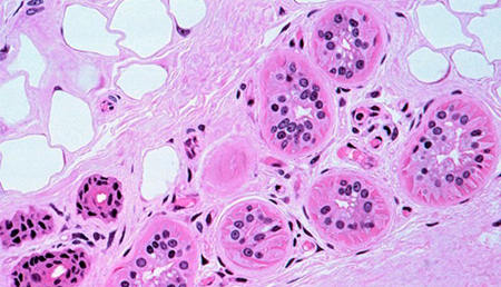 La proteína MKK6 podría permitir reducir la obesidad
