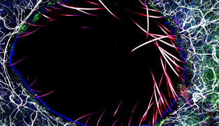 Descubren un mecanismo genético que dispara enfermedades inmunes
