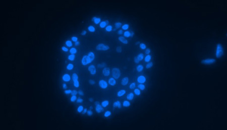 El intestino tiene un reservorio de células madre que son resistentes a la quimioterapia