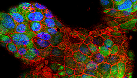 Científicos del IRB Barcelona descubren un gen crítico para el desarrollo de la placenta