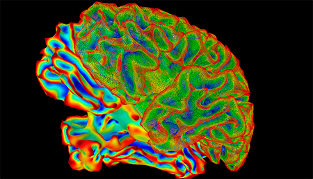 Una deficiencia en el metabolismo de las hormonas tiroideas puede derivar en trastornos emocionales.