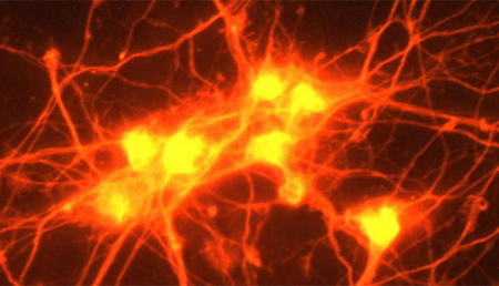 La ELA podría estar causada por hongos