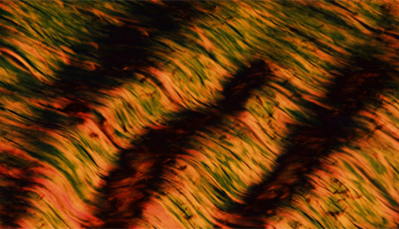 Descubren un nuevo órgano: el intersticio humano