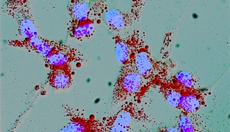 Identificada una nueva conformación del receptor humano de andrógenos, una diana clave para tratar el cáncer de próstata